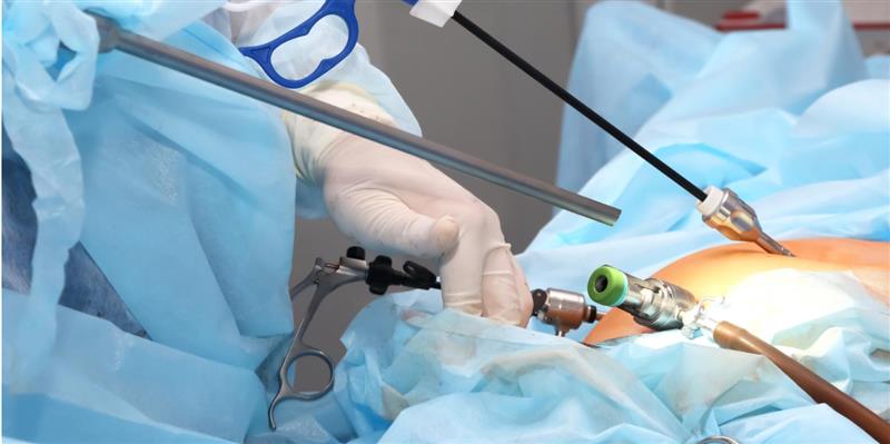 Laparoscopic Surgery